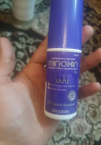 Minoxin Hair Spray 4 Bottels Xcellent result 60ml